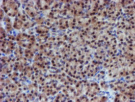 PSMD2 Antibody in Immunohistochemistry (Paraffin) (IHC (P))