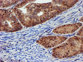 PSMD2 Antibody in Immunohistochemistry (Paraffin) (IHC (P))