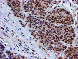 PSMD2 Antibody in Immunohistochemistry (Paraffin) (IHC (P))