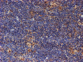 PSMD2 Antibody in Immunohistochemistry (Paraffin) (IHC (P))