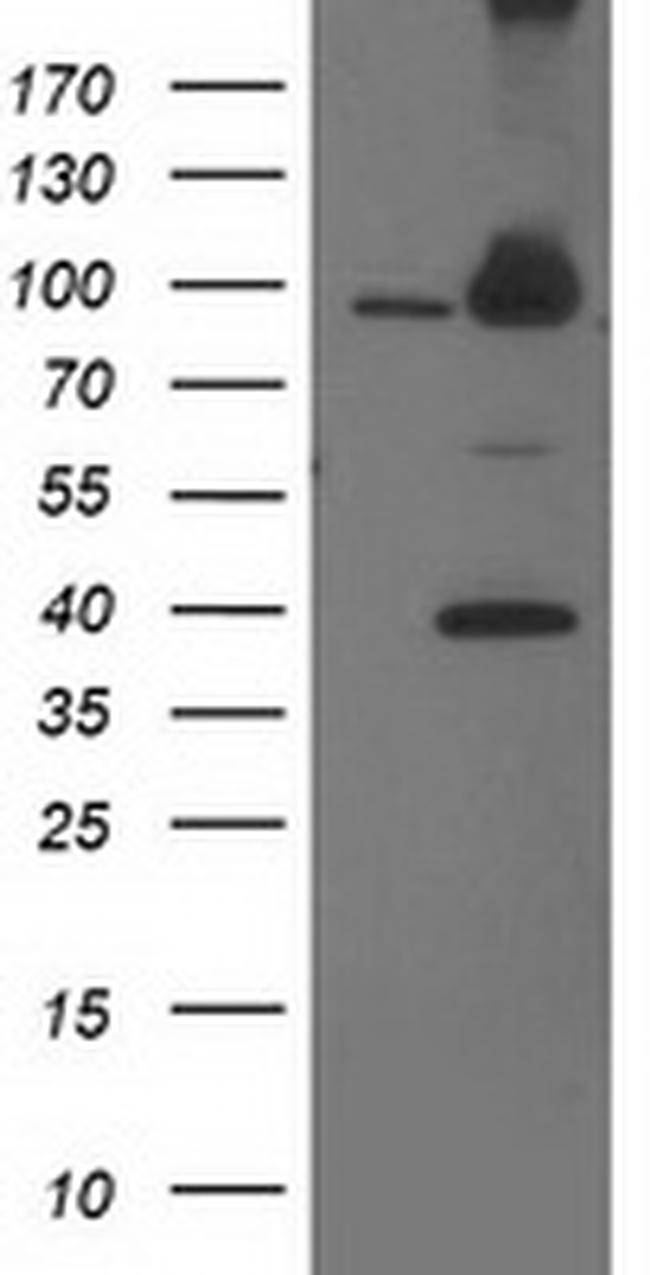 PSMD2 Antibody in Western Blot (WB)