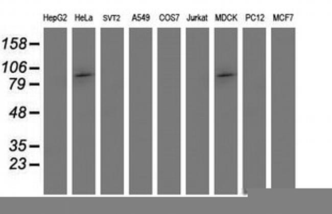 PSMD2 Antibody in Western Blot (WB)