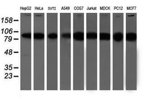 PSMD2 Antibody in Western Blot (WB)