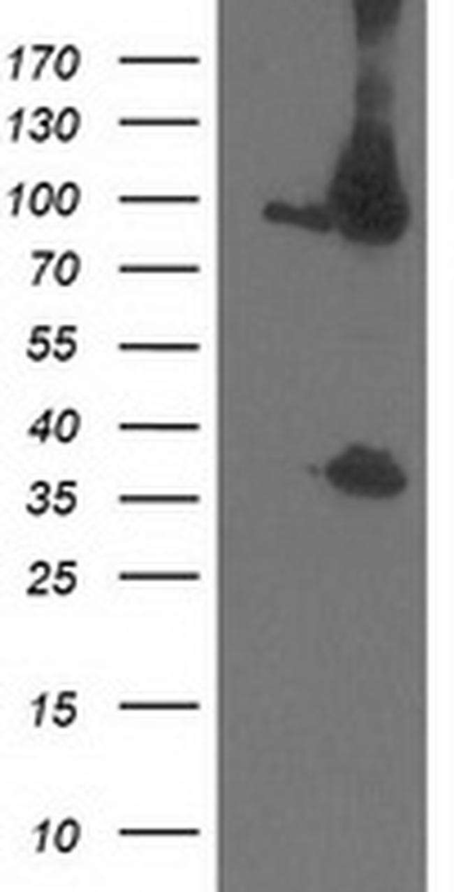 PSMD2 Antibody in Western Blot (WB)