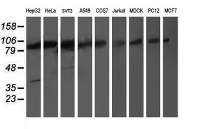 PSMD2 Antibody in Western Blot (WB)