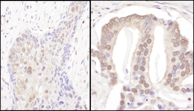 PSMD3 Antibody in Immunohistochemistry (IHC)