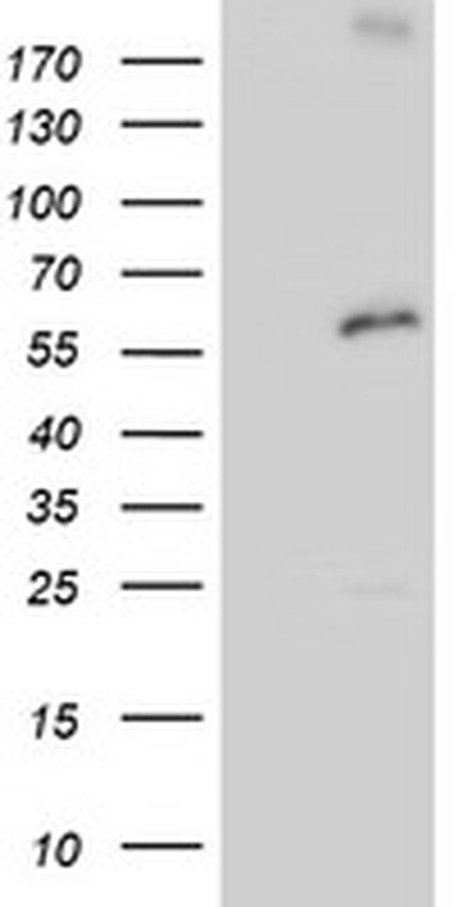 PSMD3 Antibody in Western Blot (WB)