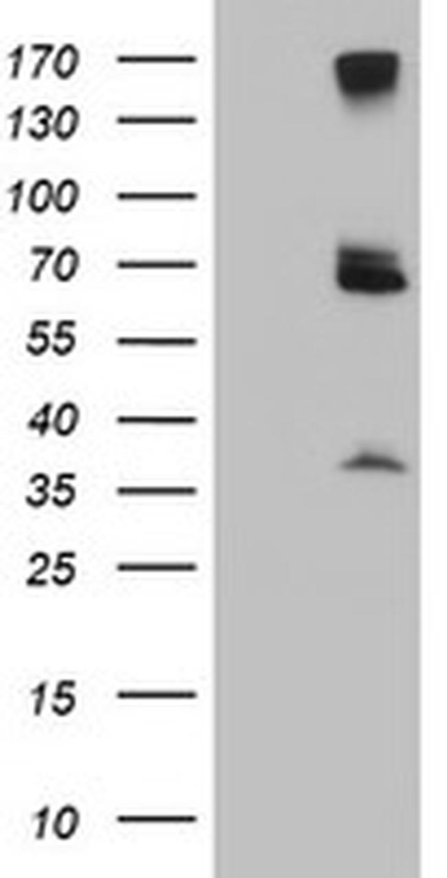 PSMD3 Antibody in Western Blot (WB)