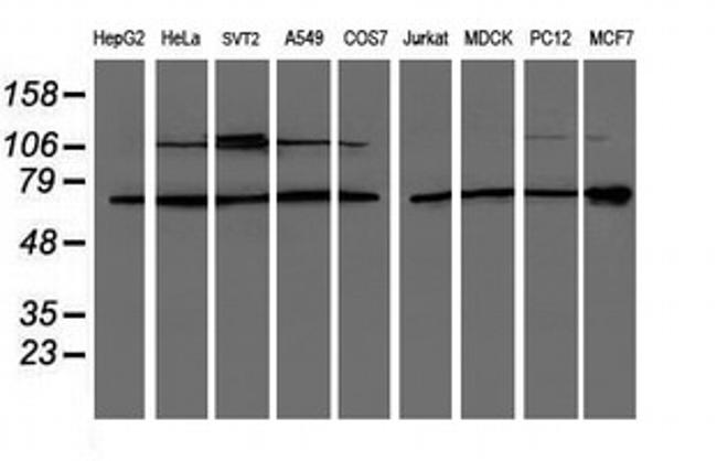 PSMD3 Antibody in Western Blot (WB)