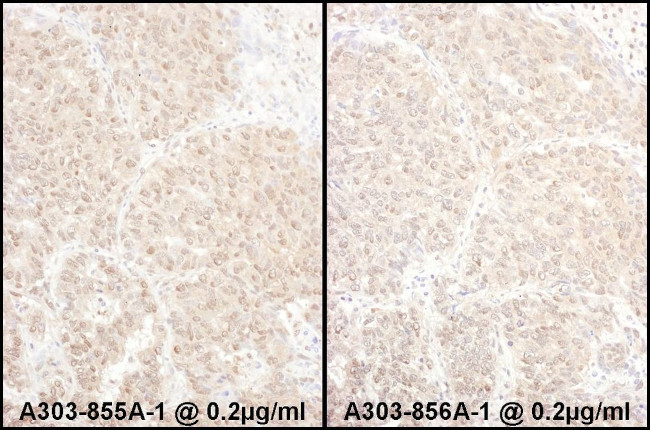 PSMD4 Antibody in Immunohistochemistry (IHC)