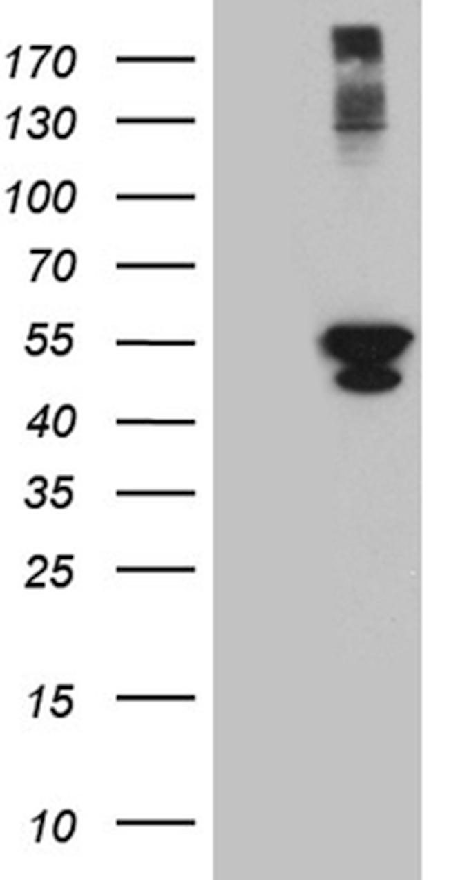 PSMD5 Antibody in Western Blot (WB)