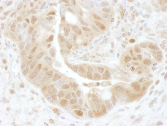 PSMD7 Antibody in Immunohistochemistry (IHC)