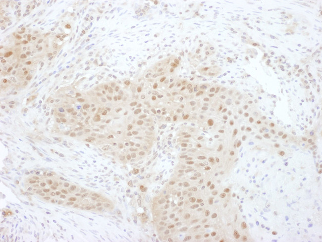 PSMD7 Antibody in Immunohistochemistry (IHC)