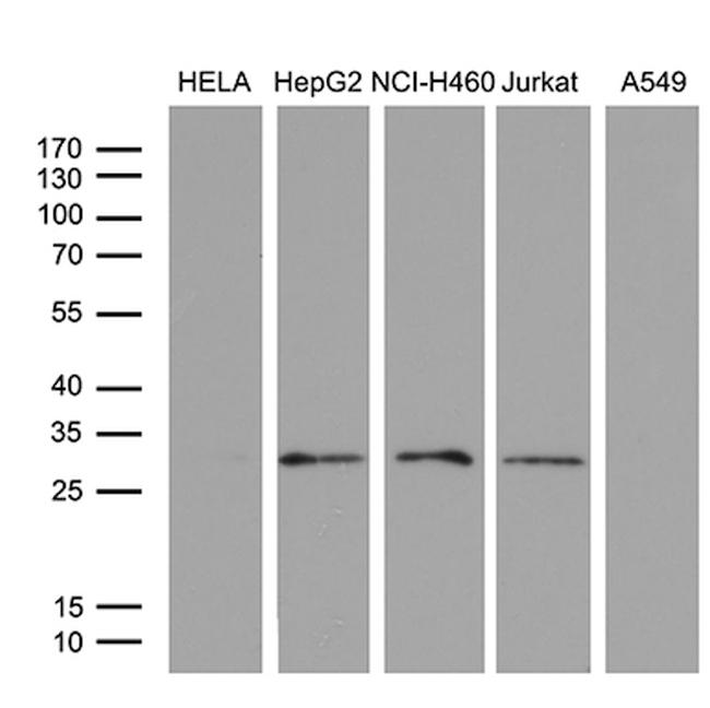 PSMD9 Antibody in Western Blot (WB)