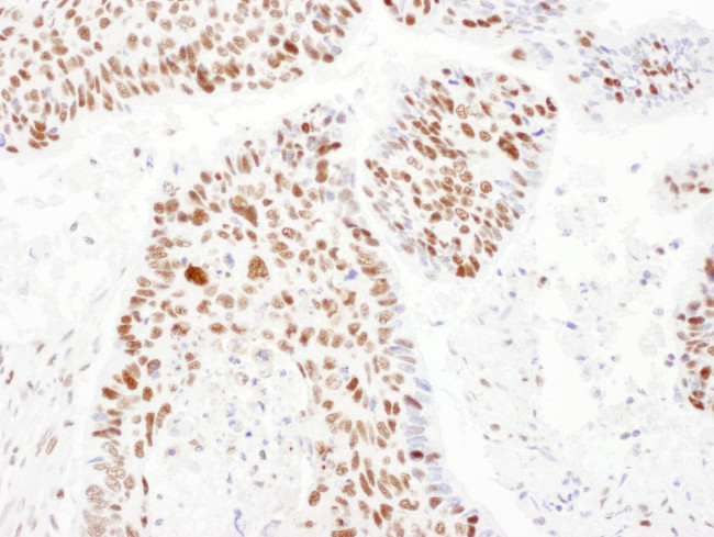 PSME3 Antibody in Immunohistochemistry (IHC)