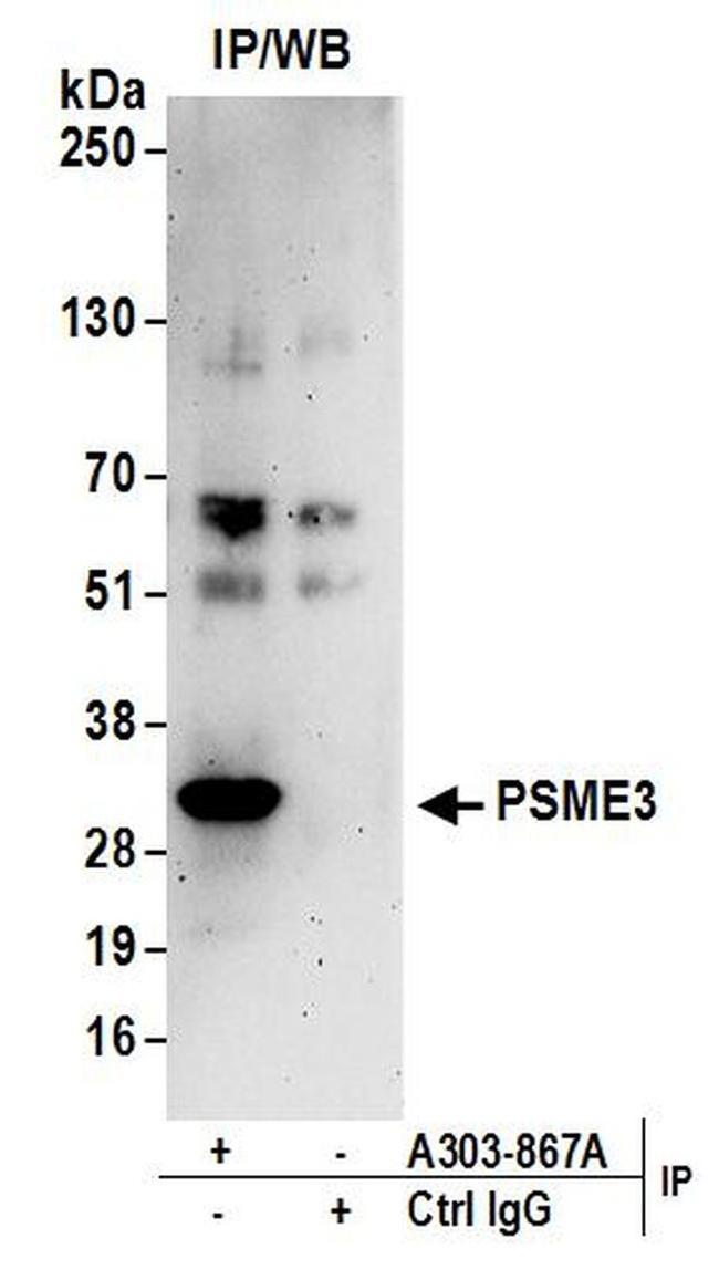 PSME3 Antibody in Western Blot (WB)