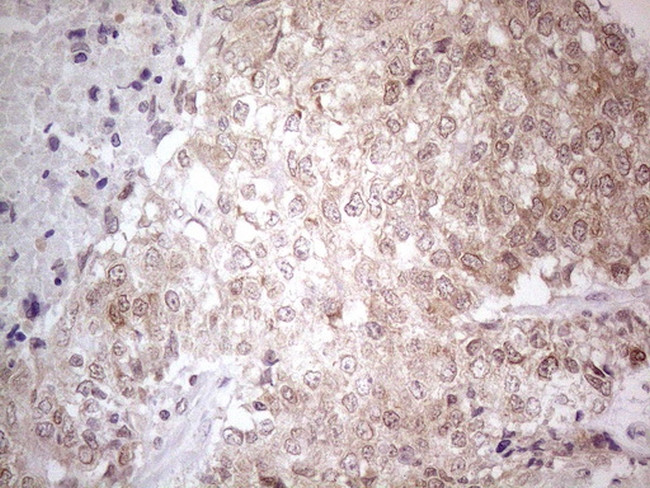 PSMG2 Antibody in Immunohistochemistry (Paraffin) (IHC (P))