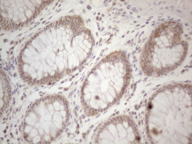 PSMG2 Antibody in Immunohistochemistry (Paraffin) (IHC (P))