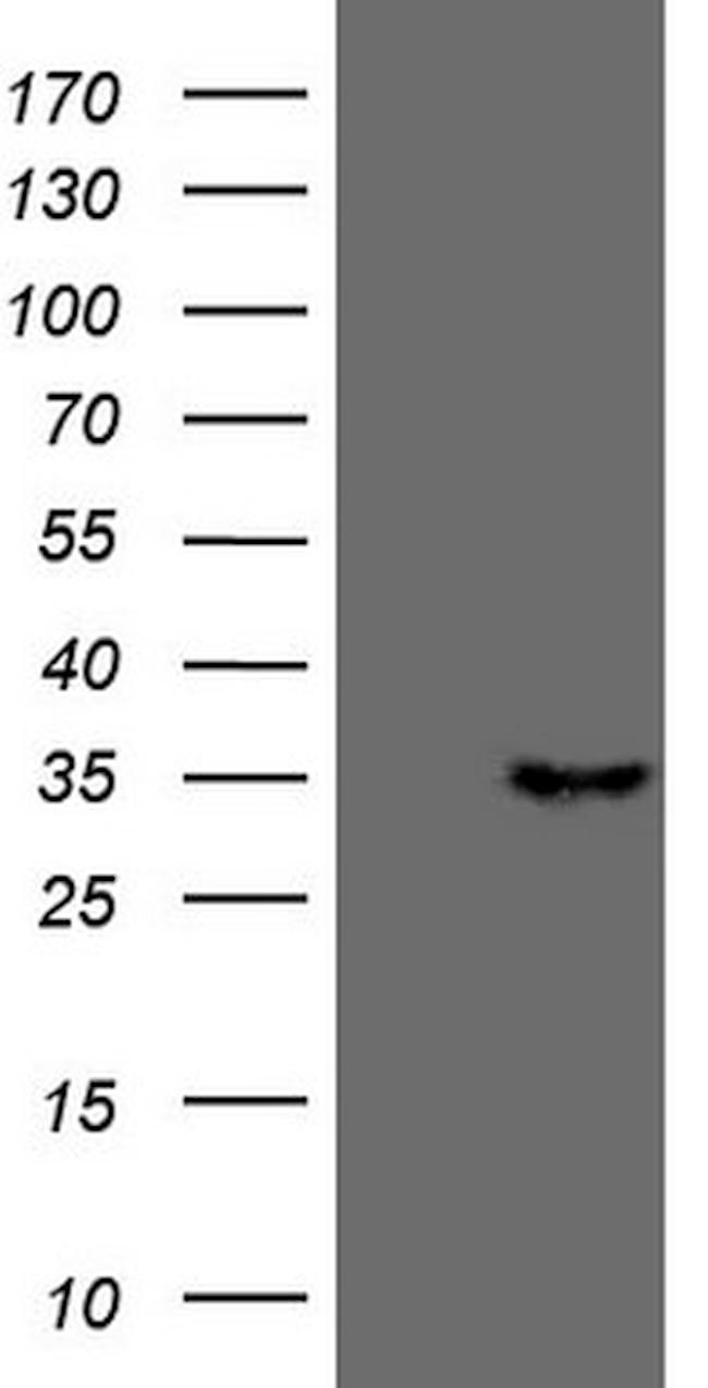 PSMG2 Antibody in Western Blot (WB)