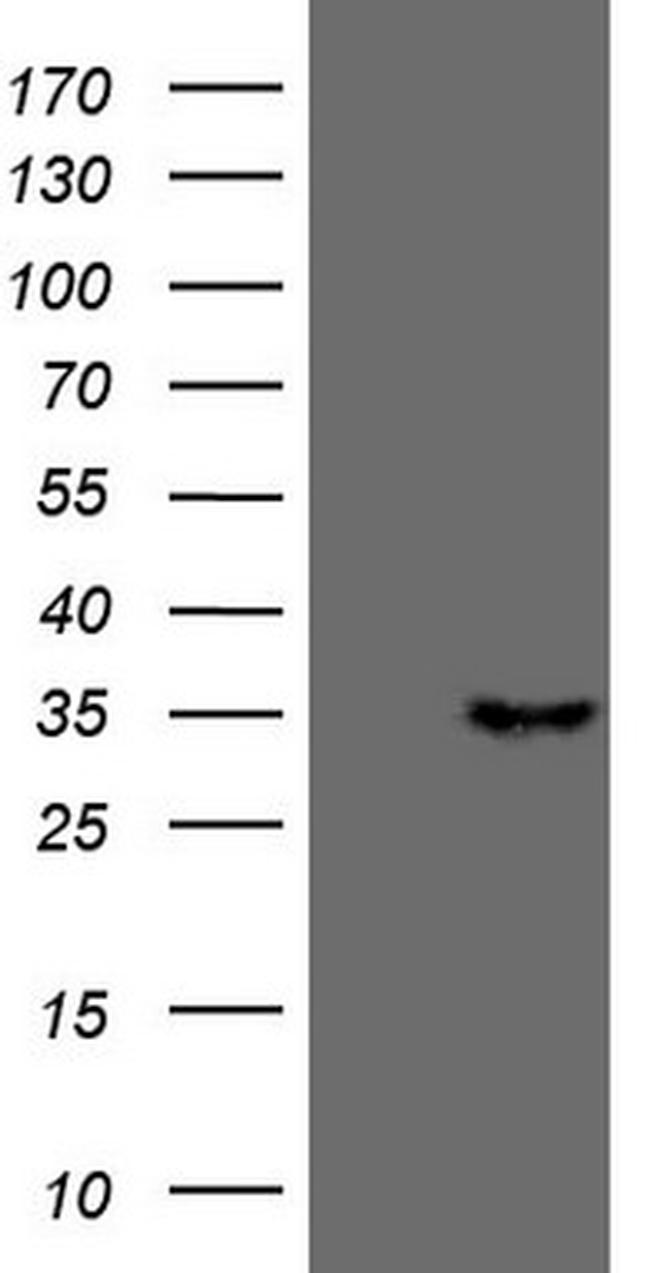 PSMG2 Antibody in Western Blot (WB)