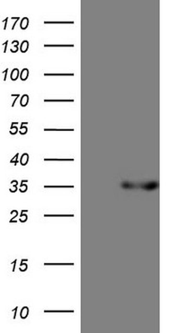 PSMG2 Antibody in Western Blot (WB)