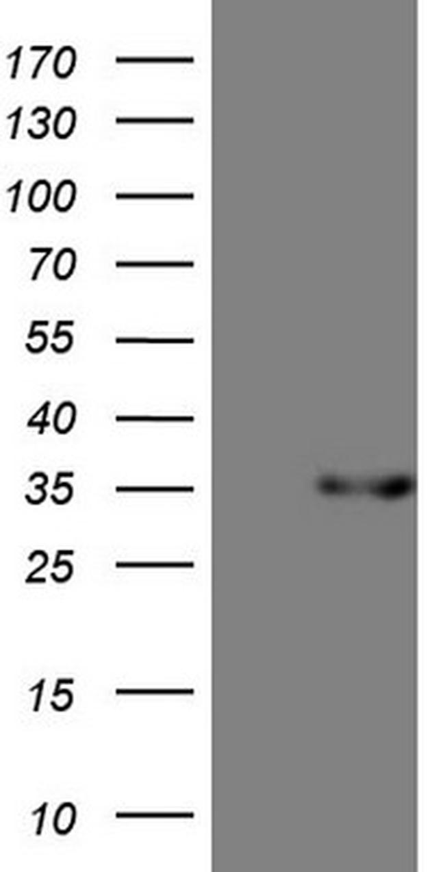 PSMG2 Antibody in Western Blot (WB)