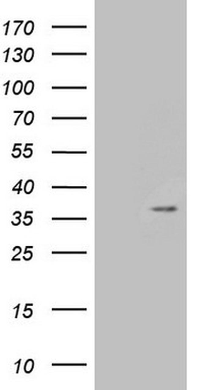 PSMG2 Antibody in Western Blot (WB)