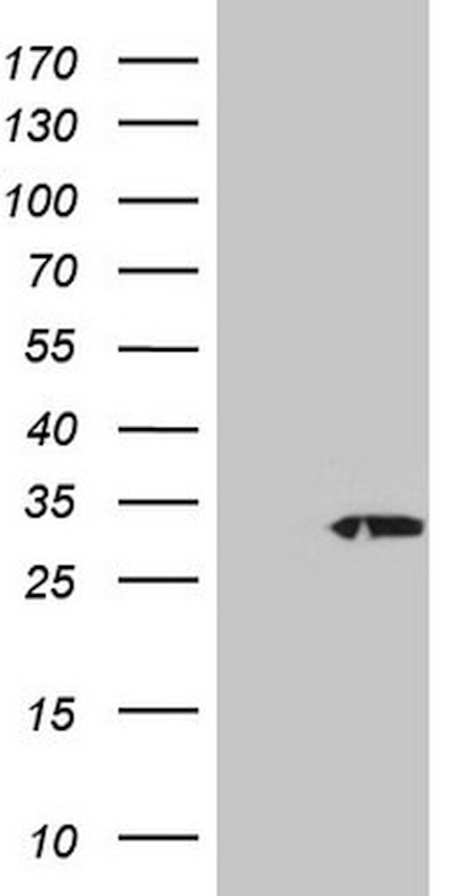 PSMG2 Antibody in Western Blot (WB)