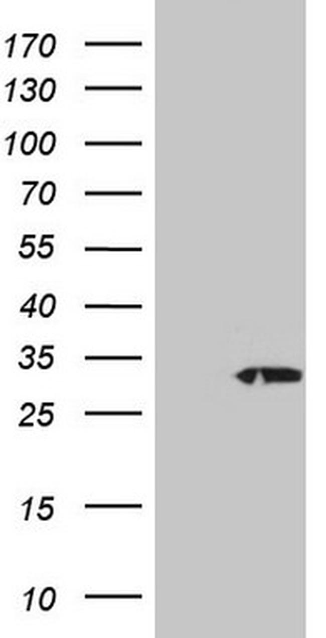 PSMG2 Antibody in Western Blot (WB)