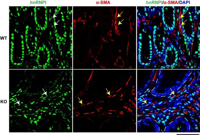 PTBP1 Antibody in Immunocytochemistry (ICC/IF)