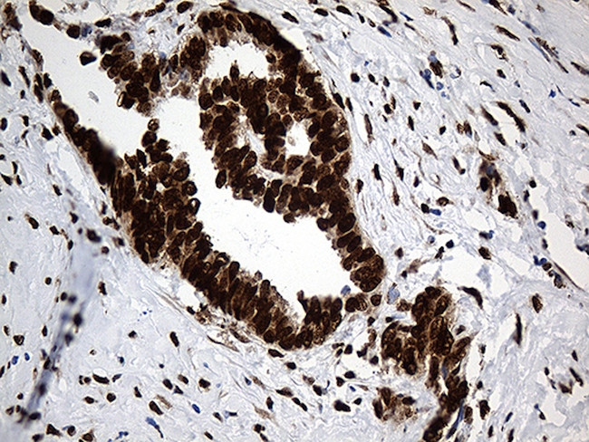 PTBP3 Antibody in Immunohistochemistry (Paraffin) (IHC (P))