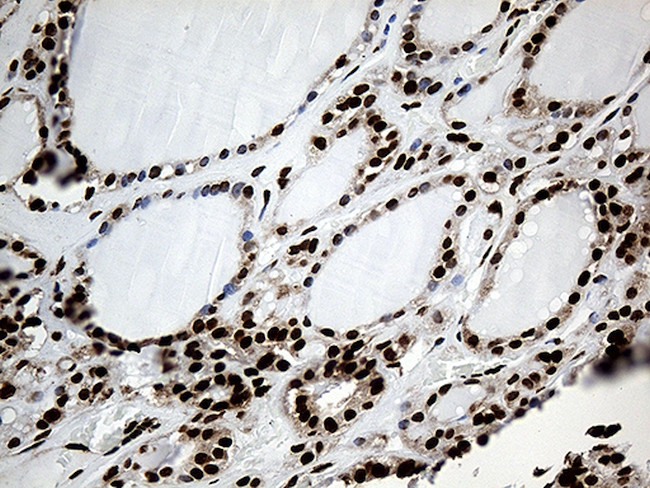 PTBP3 Antibody in Immunohistochemistry (Paraffin) (IHC (P))