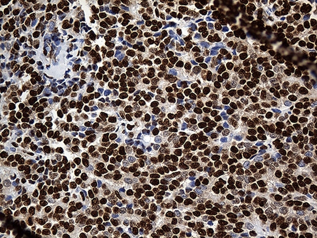 PTBP3 Antibody in Immunohistochemistry (Paraffin) (IHC (P))