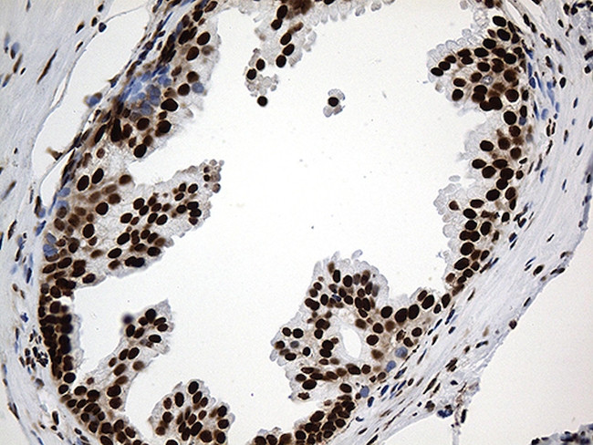 PTBP3 Antibody in Immunohistochemistry (Paraffin) (IHC (P))