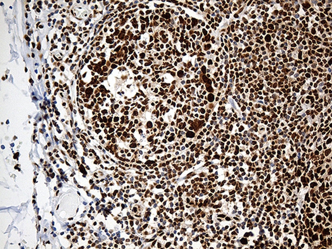 PTBP3 Antibody in Immunohistochemistry (Paraffin) (IHC (P))