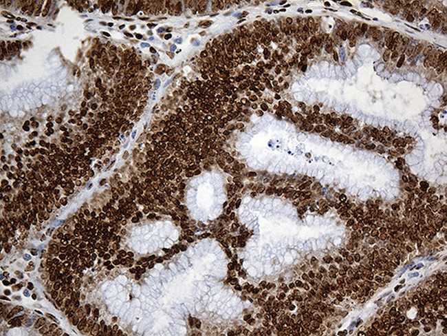 PTBP3 Antibody in Immunohistochemistry (Paraffin) (IHC (P))