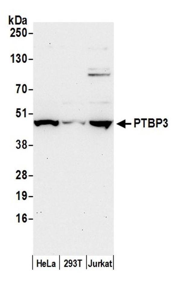 PTBP3/ROD1 Antibody in Western Blot (WB)