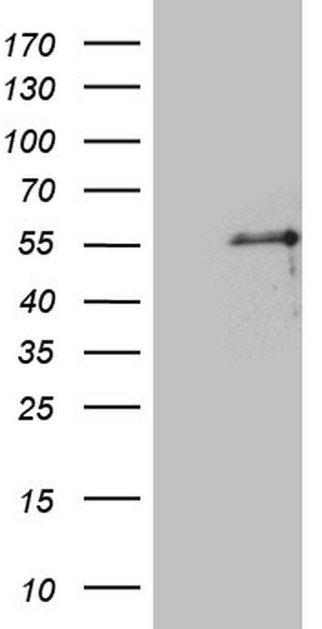 PTF1A Antibody in Western Blot (WB)