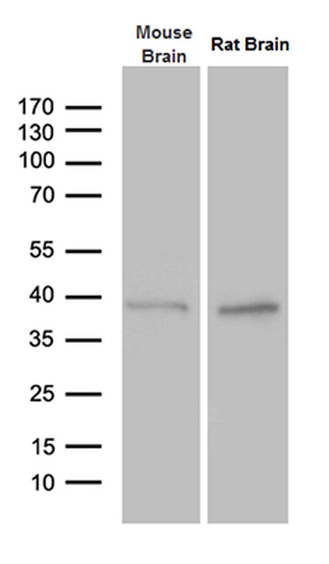 PTF1A Antibody in Western Blot (WB)