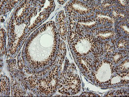 PTGES2 Antibody in Immunohistochemistry (Paraffin) (IHC (P))