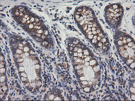 PTGES2 Antibody in Immunohistochemistry (Paraffin) (IHC (P))