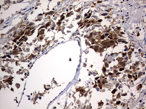 PTGES3 Antibody in Immunohistochemistry (Paraffin) (IHC (P))