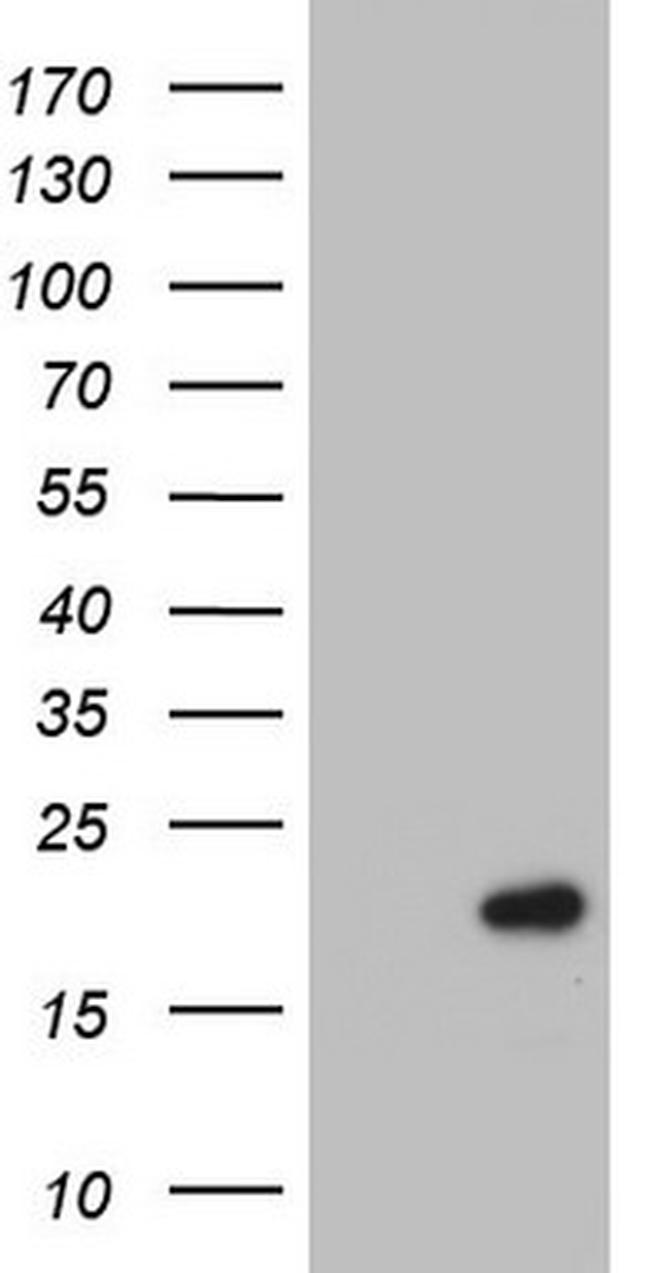 PTGES3 Antibody in Western Blot (WB)