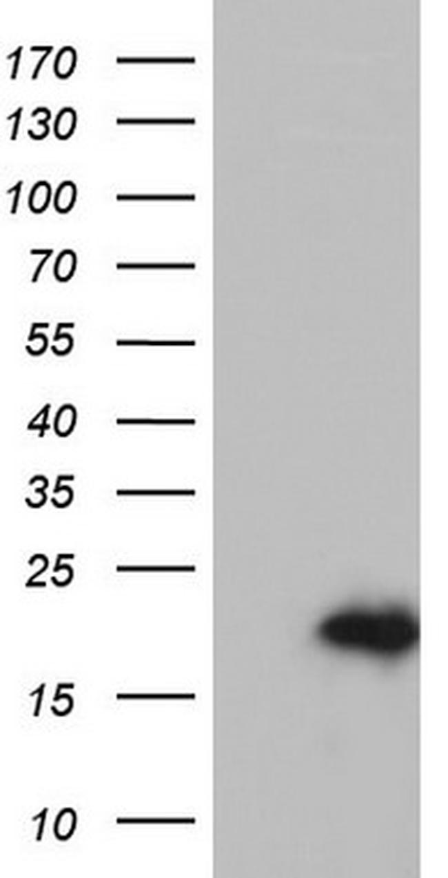 PTGES3 Antibody in Western Blot (WB)