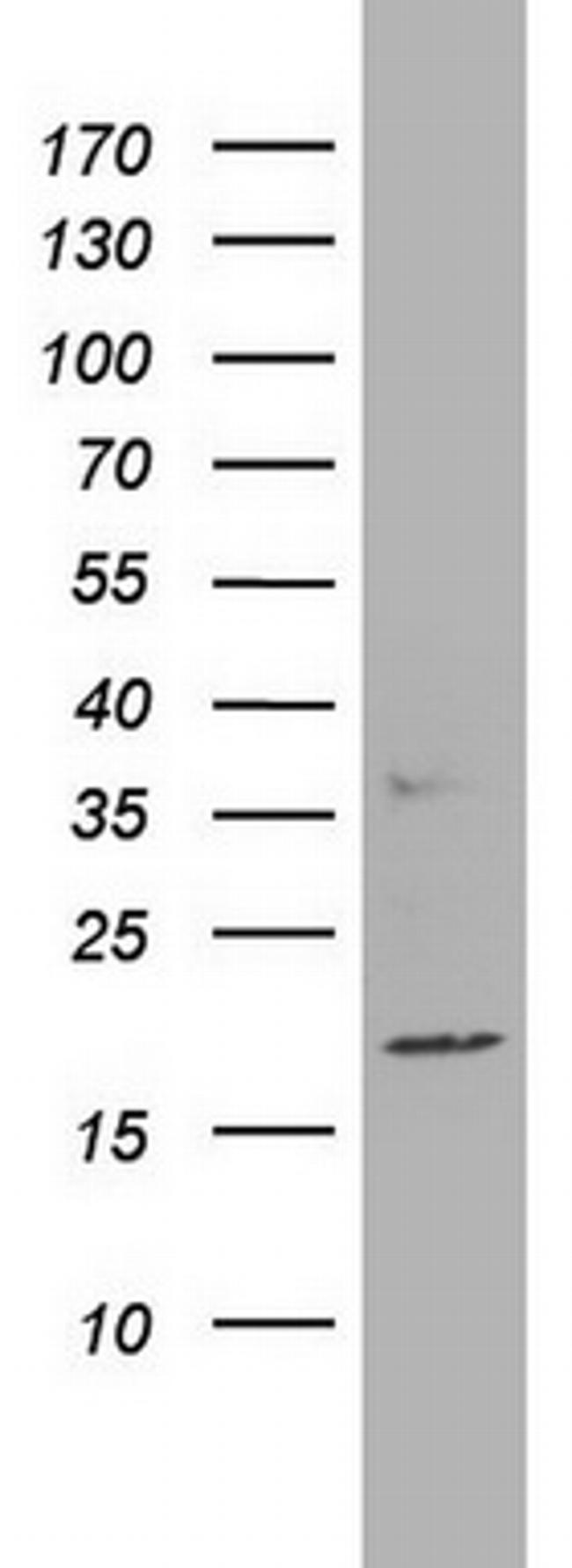 PTGES3 Antibody in Western Blot (WB)