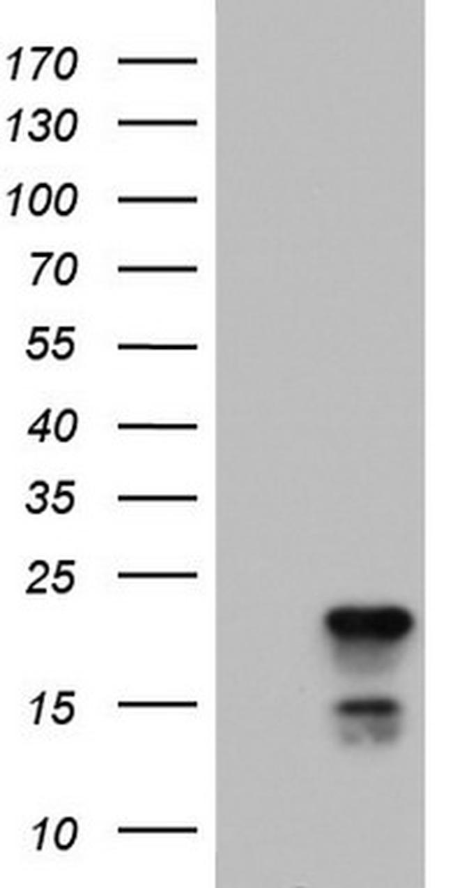 PTGES3 Antibody in Western Blot (WB)