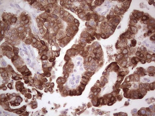 PTGS2 Antibody in Immunohistochemistry (Paraffin) (IHC (P))