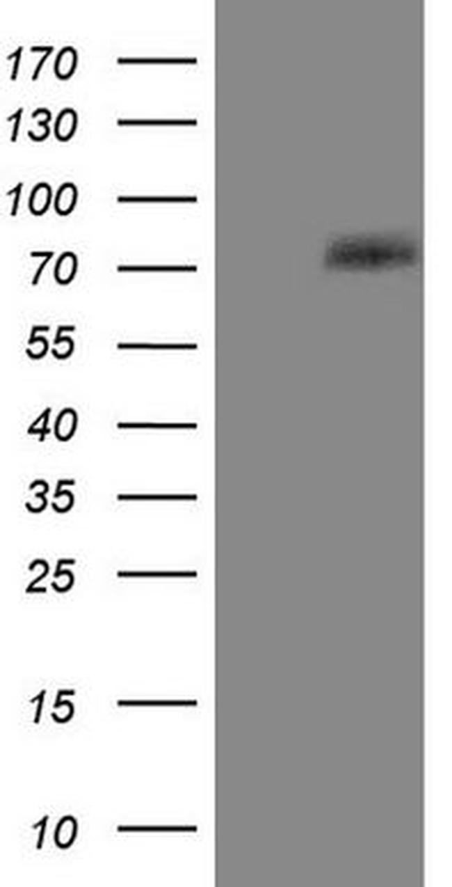 PTGS2 Antibody in Western Blot (WB)