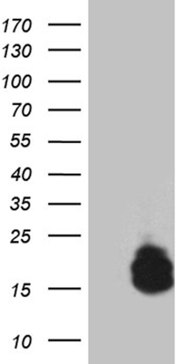 PTH Antibody in Western Blot (WB)