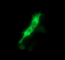 PTK2 Antibody in Immunocytochemistry (ICC/IF)